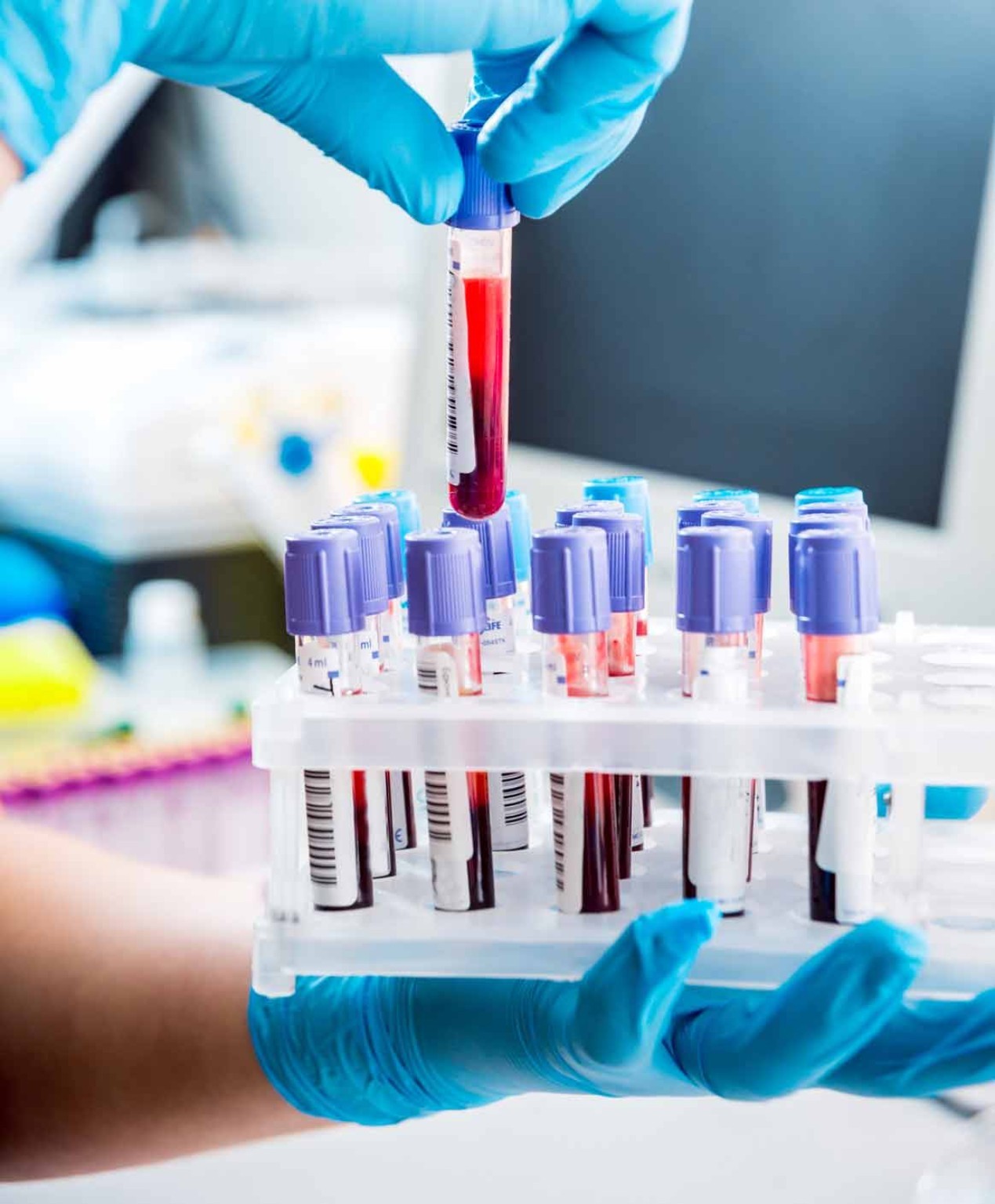 Biocon Healthcare laboratory gallery image